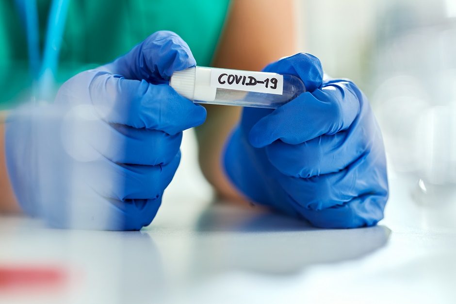 Koronaviruso statistika: 21 naujas atvejis, mirčių nefiksuota