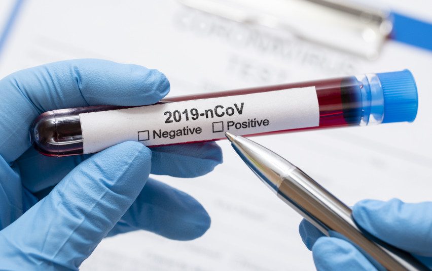 Lietuvoje patvirtinti septyni nauji koronaviruso atvejai (patikslinta)